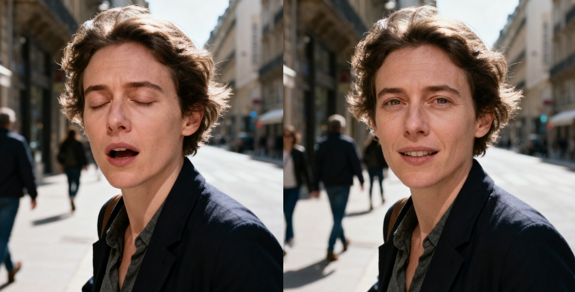 Improve Expression and Facial Symmetry